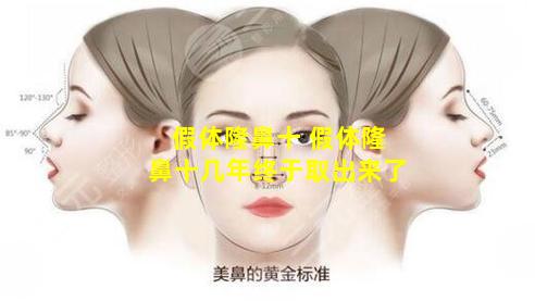 假体隆鼻十 假体隆鼻十几年终于取出来了